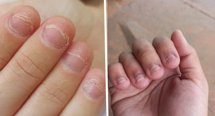 Unhas
