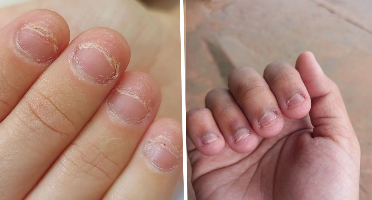 Unhas