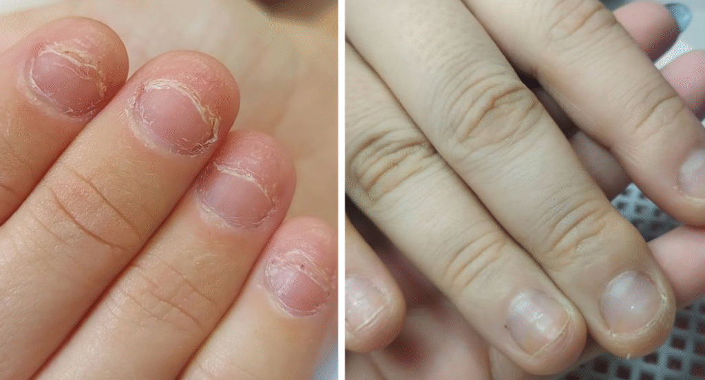 Roer as unhas